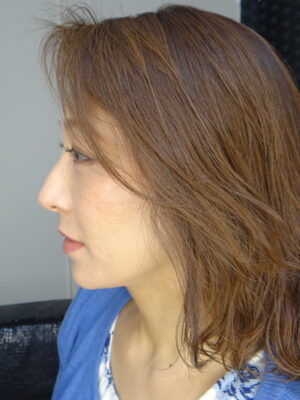 dent-06　松本まりな
